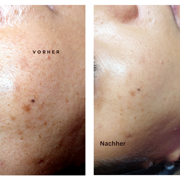 VITAMIN C SET  -  150ML + 30 ML +30ML