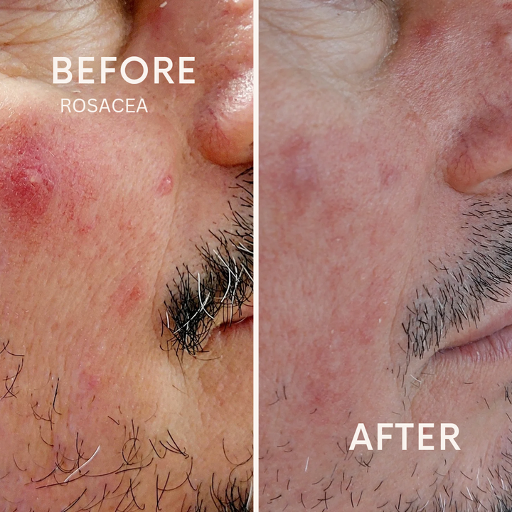 TOP DERM TRANSFORM 1 - 5%  - 30ml